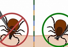 Как удалить клеща, если он присосался? 