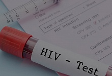 В Коми ежедневно регистрируется один новый случай ВИЧ-инфекции