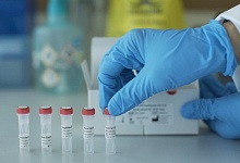 Почему анализы на COVID-19 у больного приходят быстрее, чем у контактного, объяснили медики Коми