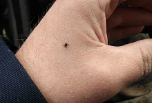 С начала сезона в медучреждения Коми обратились 427 пострадавших от клещей