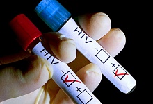 В 2017 году в Коми было выявлено 449 новых случаев ВИЧ-инфекции
